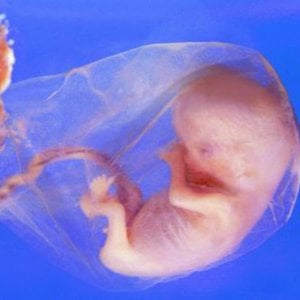 Profile picture for Missionaries to Preborn