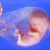 Missionaries to Preborn