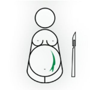 Profile picture for c-section