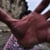 handstremor