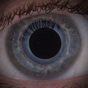 Profile picture for zac wollons