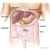 Liver Cancer Life Expectancy