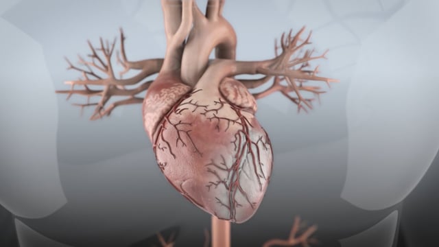 Koronarangioplastie & Risiken - DE
