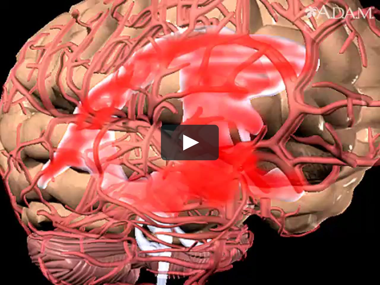 Видео сосудов головного мозга