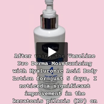 Pro Derma Moisturizing with Hyaluronic Acid Body Lotion