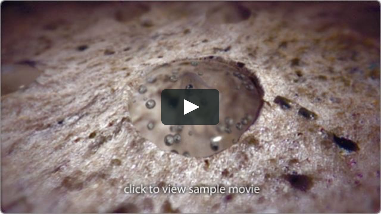 Osteoporosis - Medical Animation on Vimeo