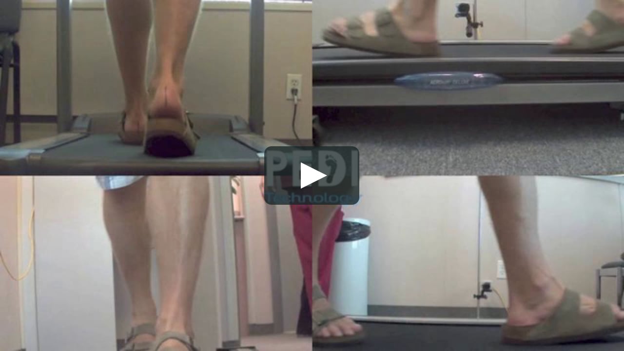 Orthotic Sandals: Do they really improve foot function?orthotics heel pain mississauga brantford podiatry chiropody on Vimeo