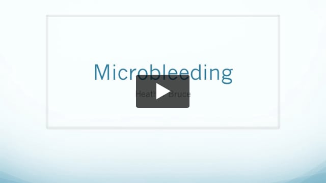Microbleeding - NZRA 2015