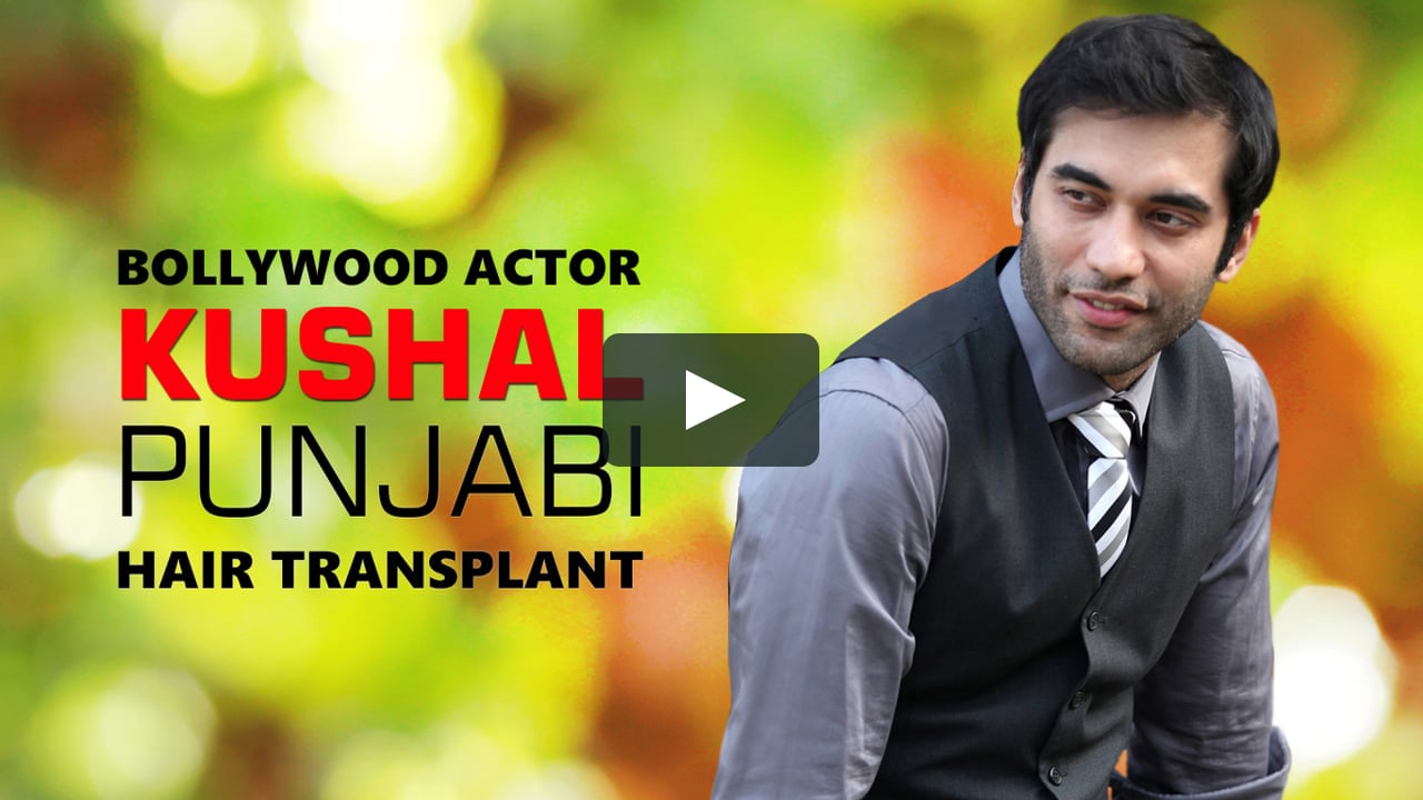 Bollywood Actor Khushal Punjabi Gets Hair Transplant | Dr. A's Clinic | Dr.  Arvind Poswal on Vimeo