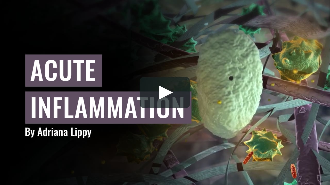 Acute Inflammation Medical Animation by Adriana Lippy on Vimeo