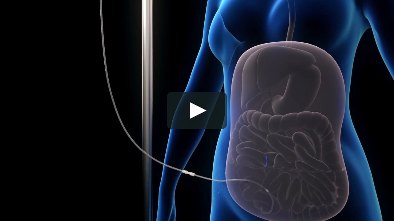 Medical Animation: Peritoneal Dialysis on Vimeo