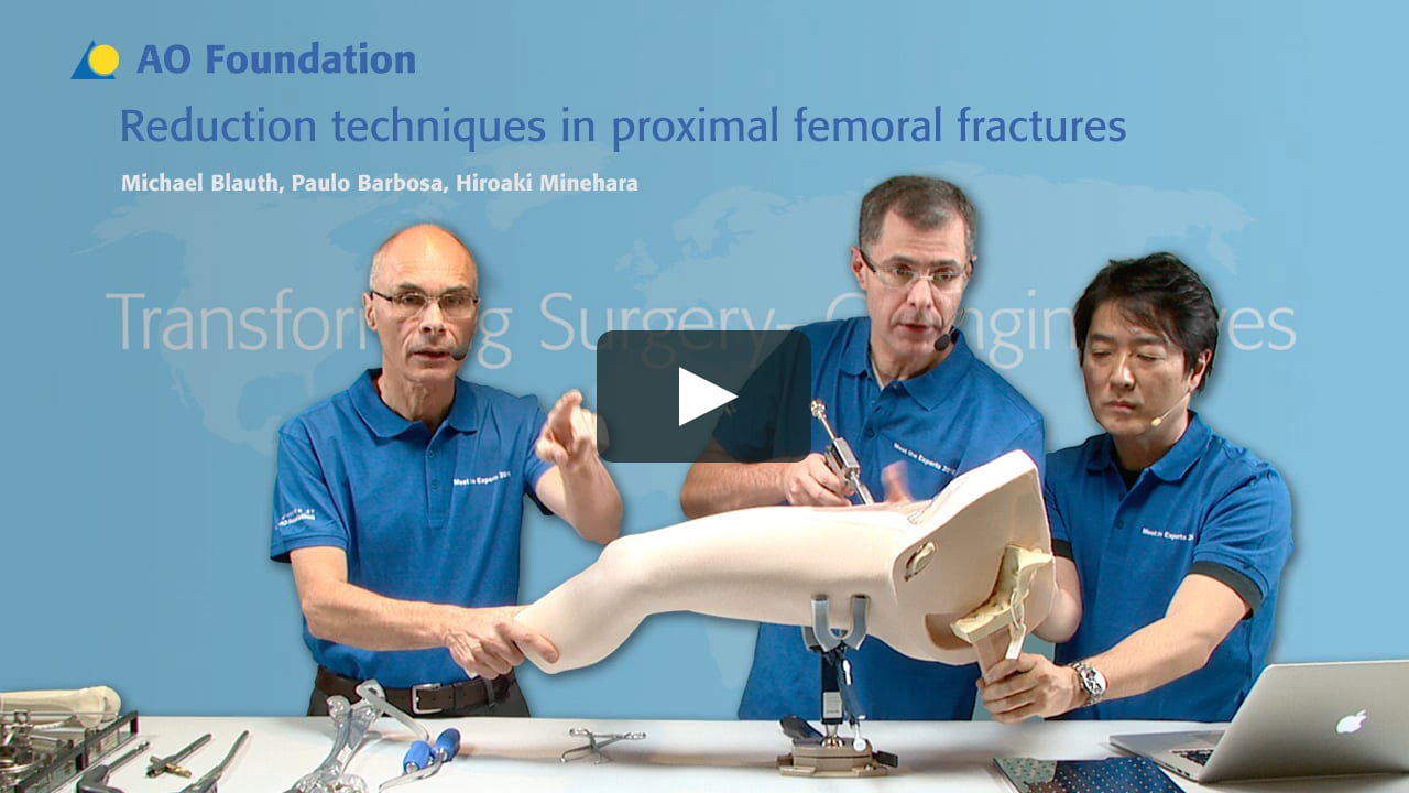 Reduction Techniques In Proximal Femoral Fractures On Vimeo Reduction Techniques In Proximal Femoral Fractures On Vimeo