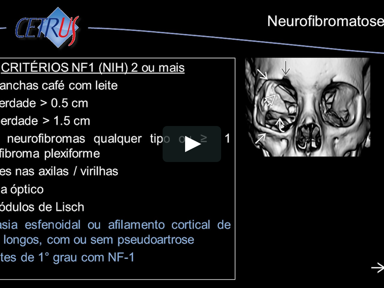 Preparatório De Radiologia 2017 Modulo Neuro Cabeça E Pescoço Preparatório Título Radiologia 5128