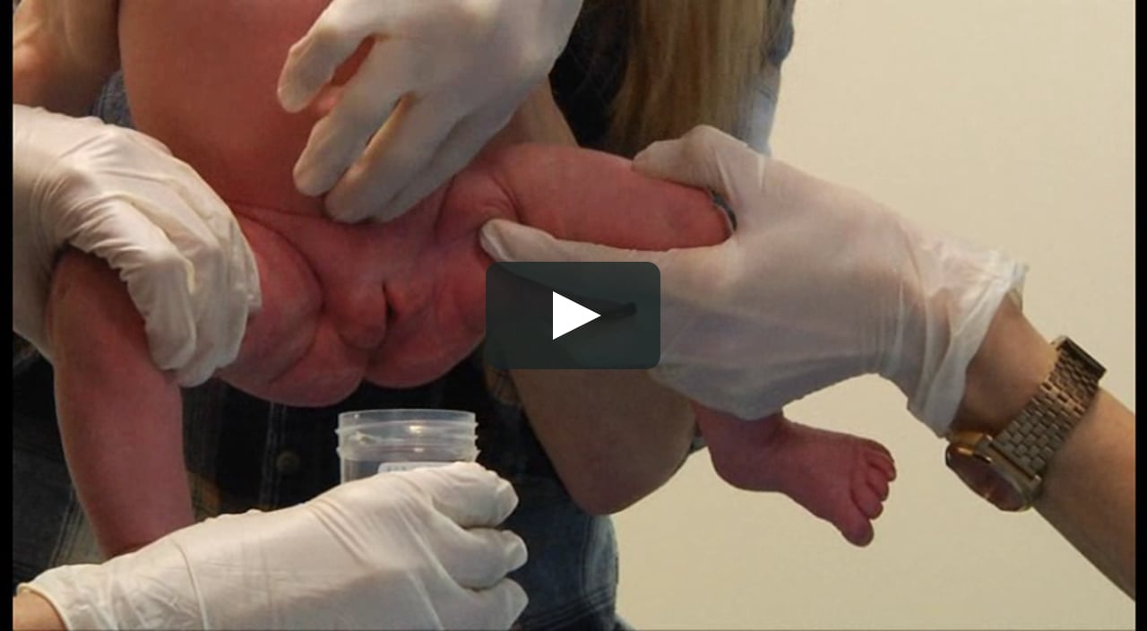 Med Prelevement D Urine Par Clean Catch Chez La Fille On Vimeo Med Prelevement D Urine Par Clean Catch Chez La Fille On Vimeo