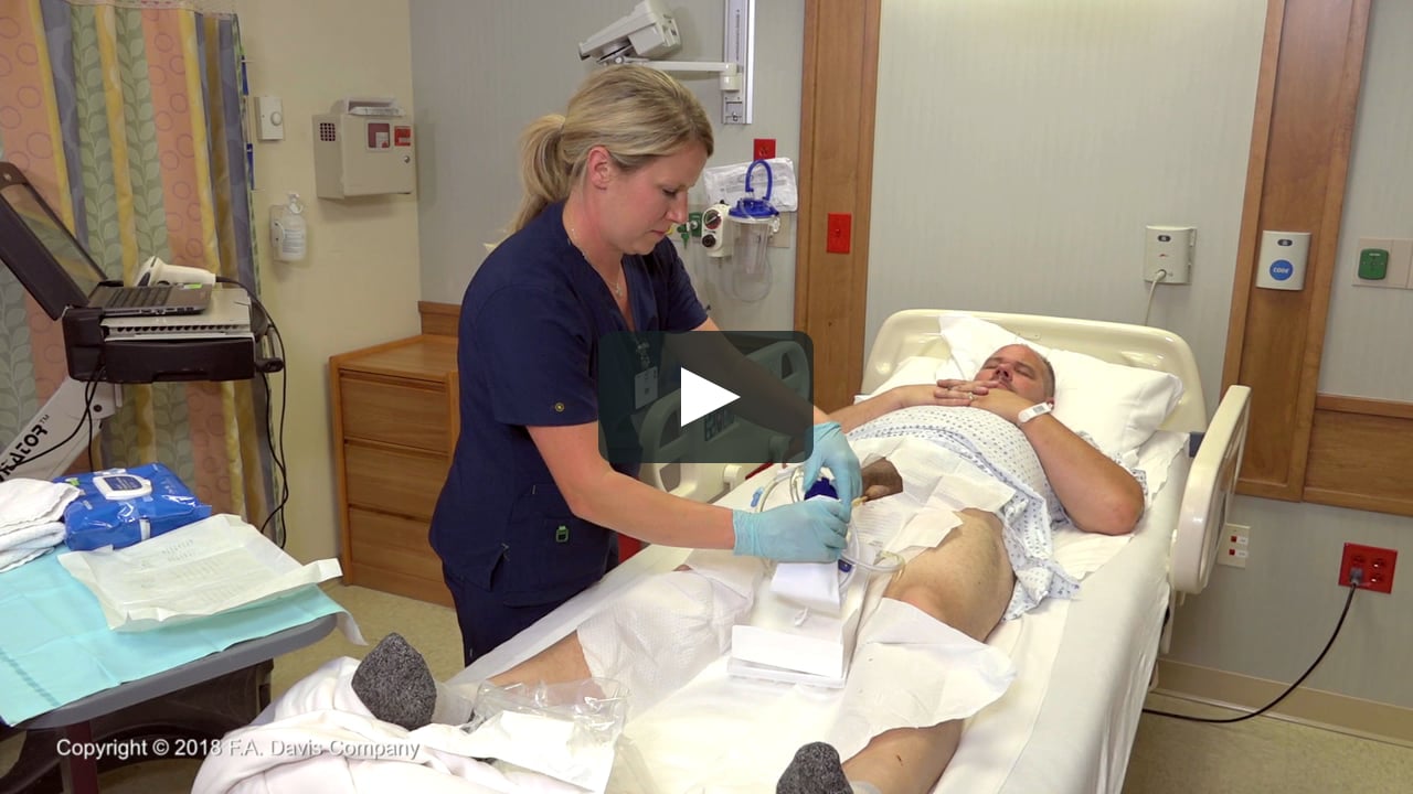 Inserting An Indwelling Urinary Catheter Male Master On Vimeo Inserting An Indwelling Urinary Catheter Male Master On Vimeo