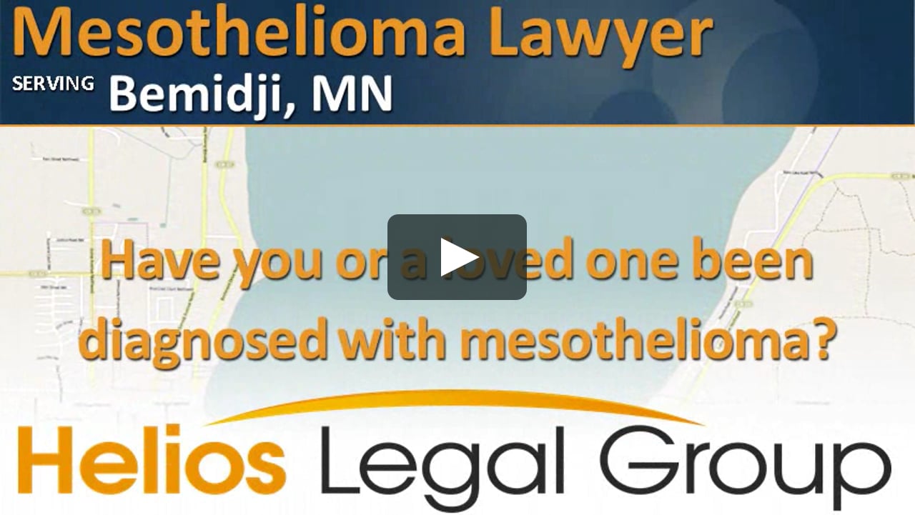 Mesothelioma Lawyer Bemidji, Minnesota on Vimeo Mesothelioma Lawyer Bemidji, Minnesota on Vimeo