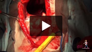How to perform a GDV surgery VETgirl Vet CE Videos