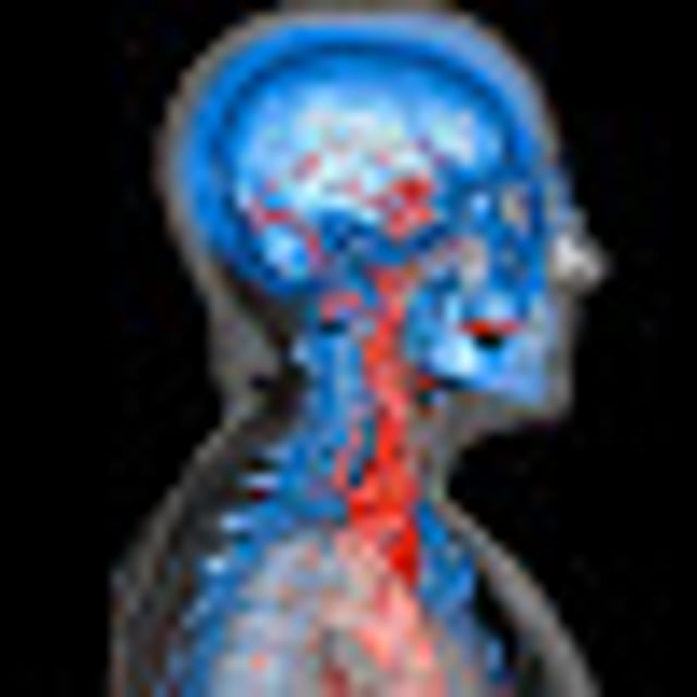 Мрт головы и шеи. Кт сосудов головного мозга и шеи. Мрт сосудов головного мозга и шеи. Анатомия сосудов головного мозга и шеи на кт.