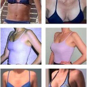 Profile picture for Breast Actives