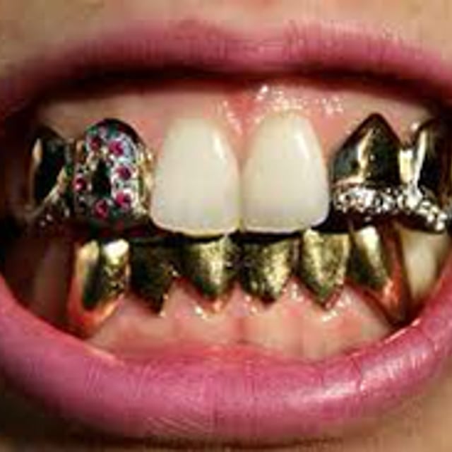 gold-teeth-caps