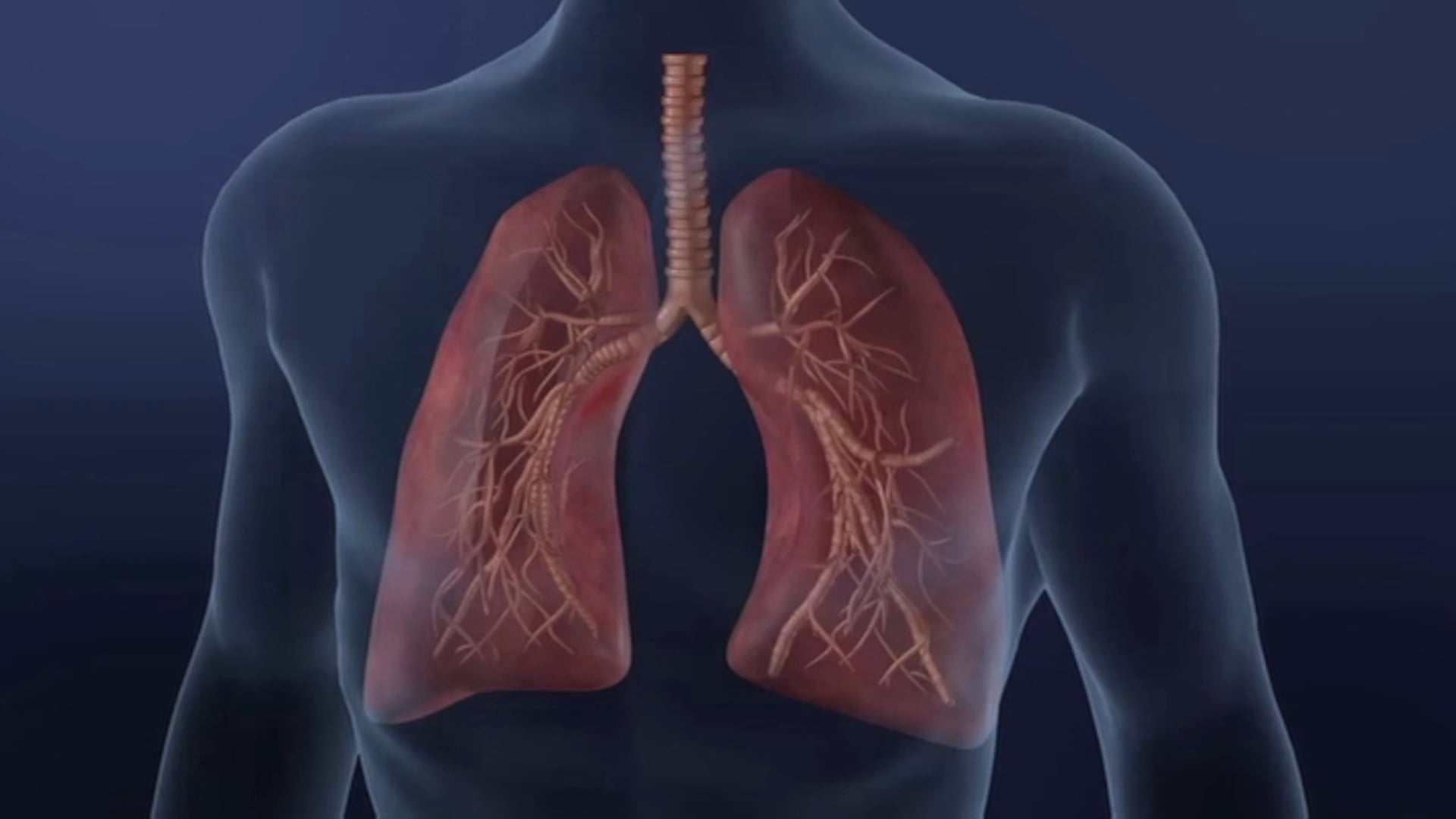 Medical Narration Voice Over