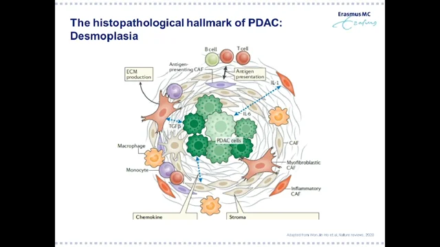 Characterization of the pancreatic tumor microenvironment using novel  quantitative multiplex DSP