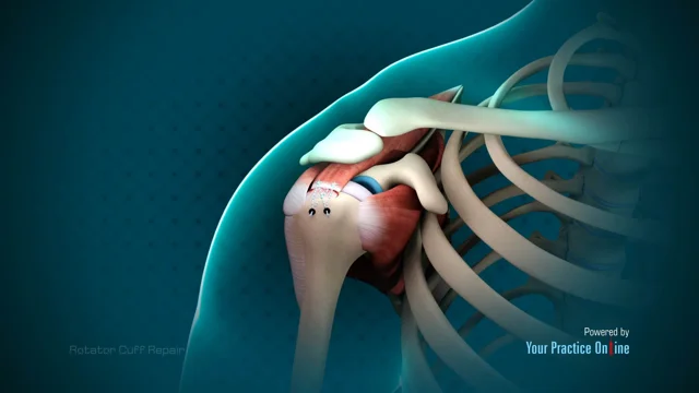 Rotator Cuff Diagnosed & Treated by Orthopedic Doctors - Mercy in Baltimore