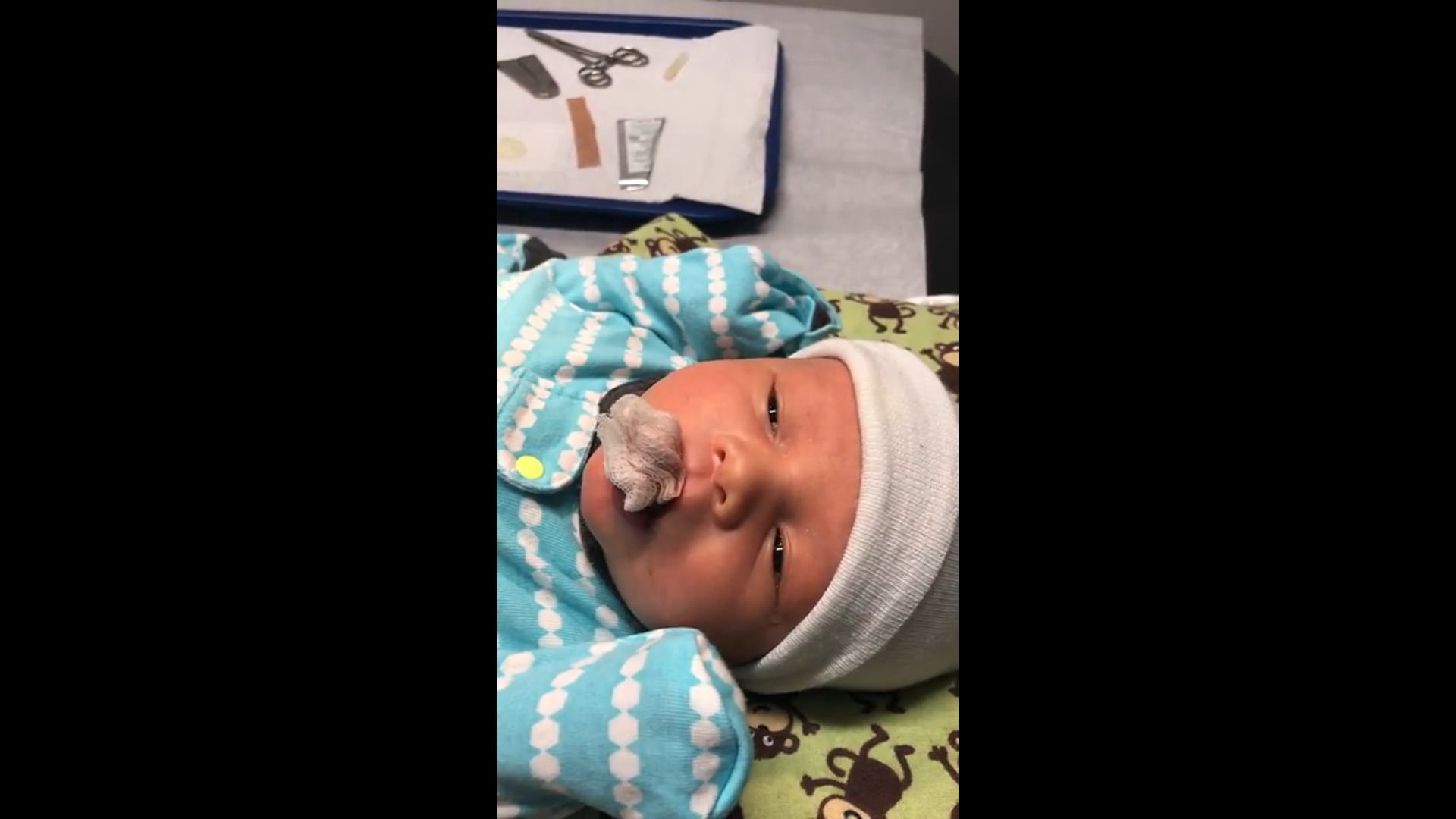 Infant Circumcision with the Pollock Technique™