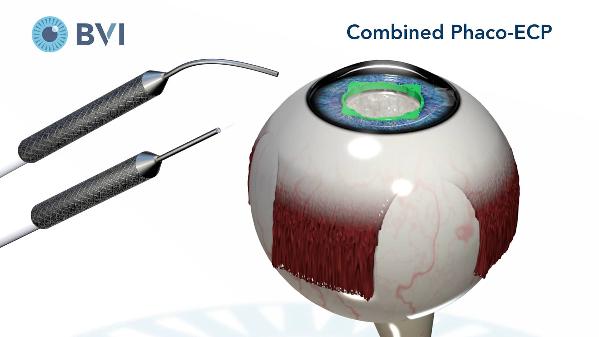 Endo Optiks Basic ECP 152064101 on Vimeo