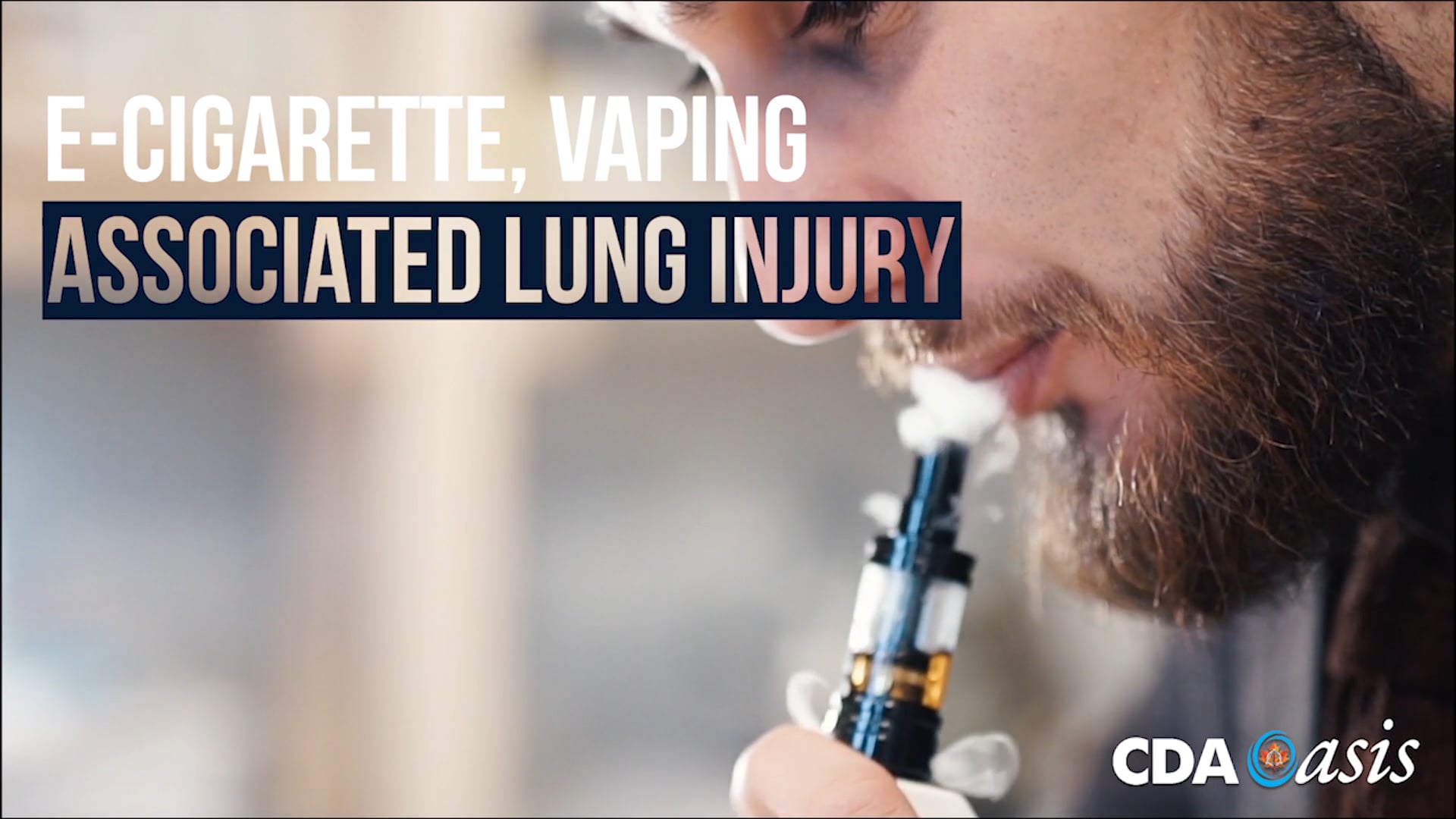 E cigarette Vaping Associated Lung Injury