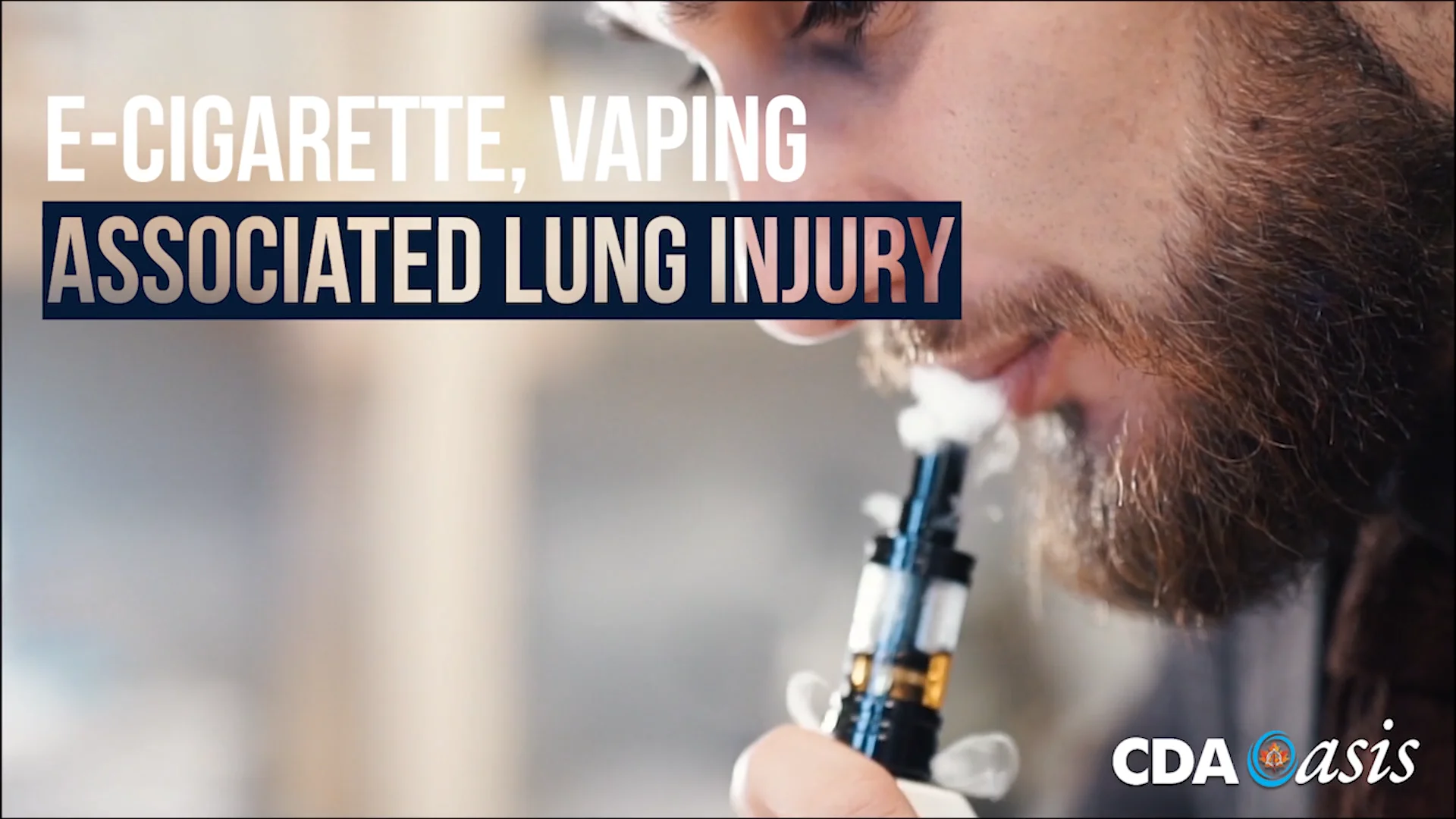 E-cigarette Vaping Associated Lung Injury