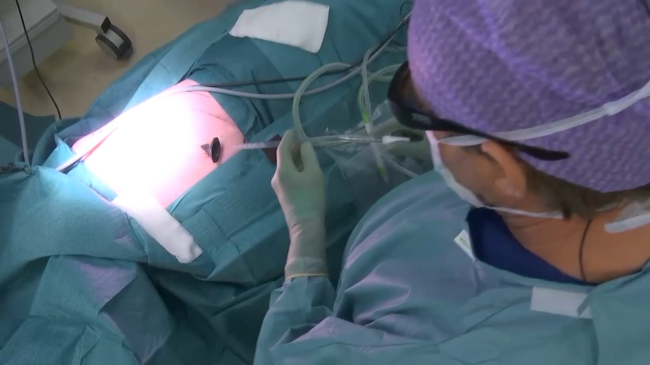 M - Video-assisted biopsy and talc pleurodesis for malignant pleural