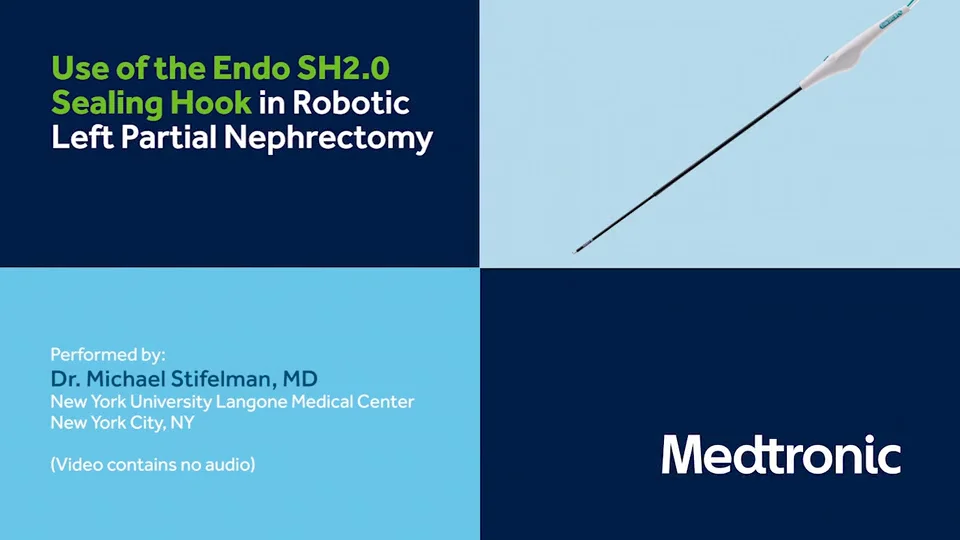 Stifelman: Use of the Endo SH2.0 Sealing Hook in Robotic Left Partial  Nephrectomy on Vimeo