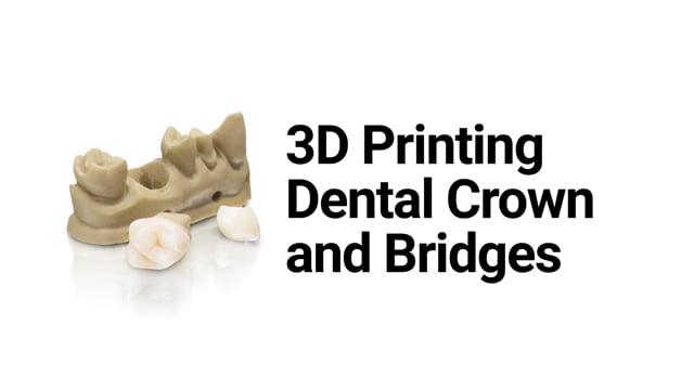 3D Print and Bridges - SprintRay