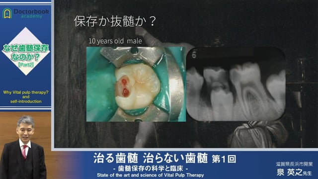 治る歯髄 治らない歯髄 - 歯髄保存の科学と臨床 - | Doctorbook 