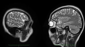 Self - Magnetic Resonance