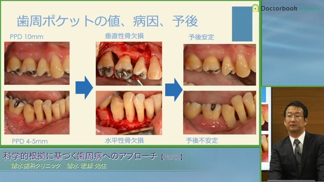 科学的根拠に基づく歯周病へのアプローチ | Doctorbook academy