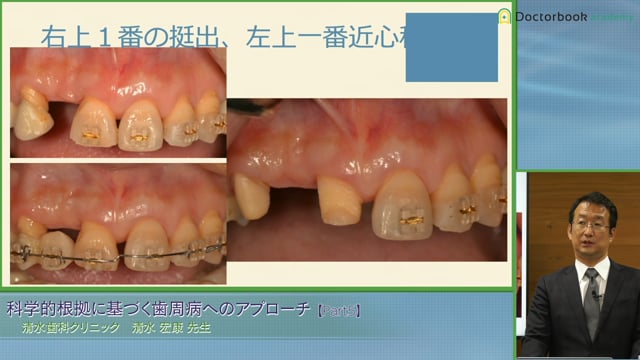 科学的根拠に基づく歯周病へのアプローチ | Doctorbook academy 