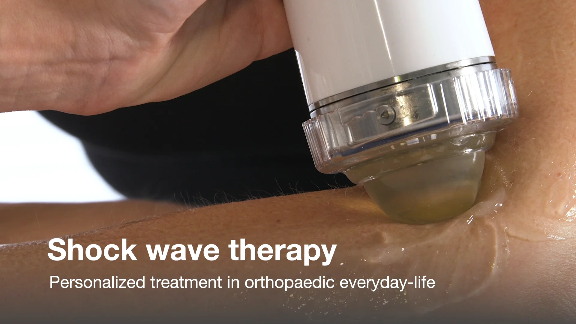 Orthopedic and Therapeutic Treatments Using Shockwave Therapy