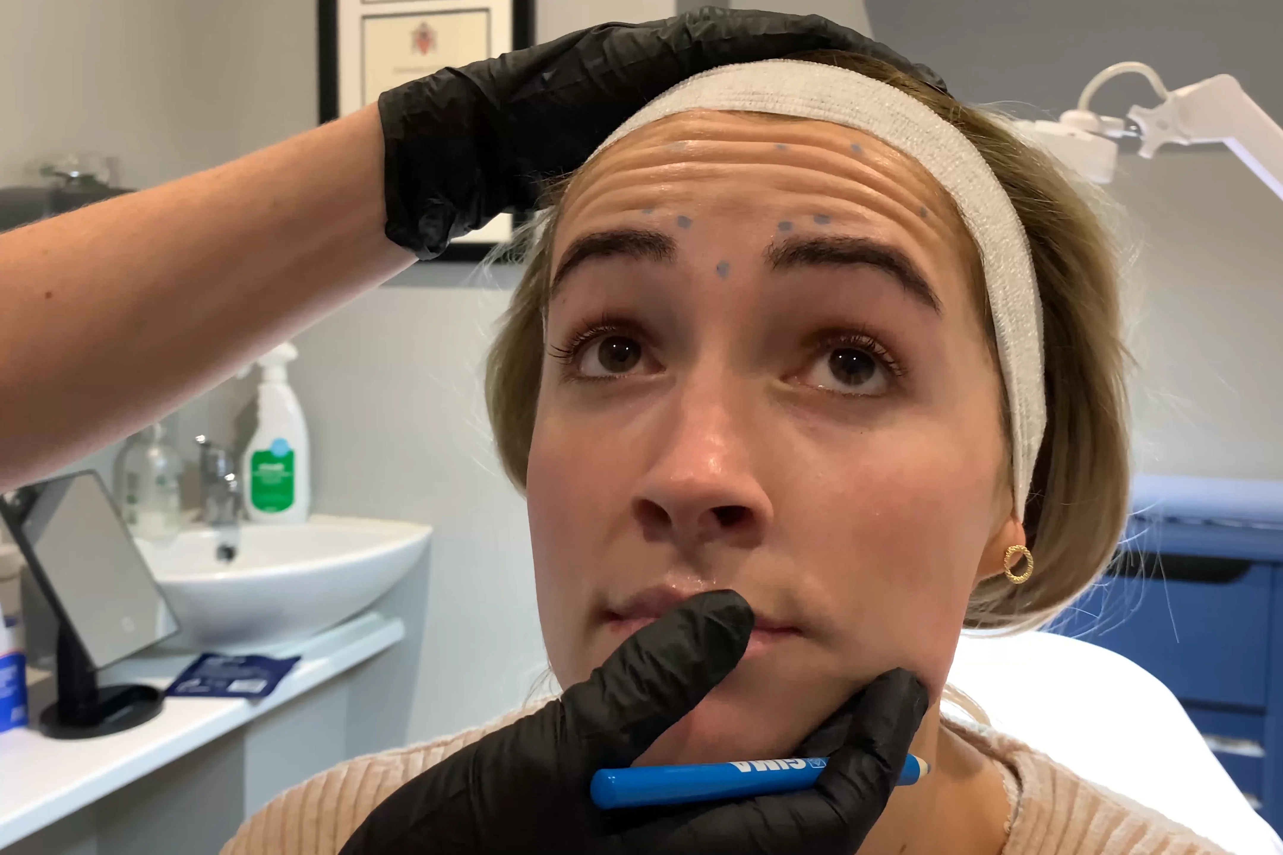 FACIAL LINE SOFTENING WITH BOTULINUM TOXIN TYPE A on Vimeo