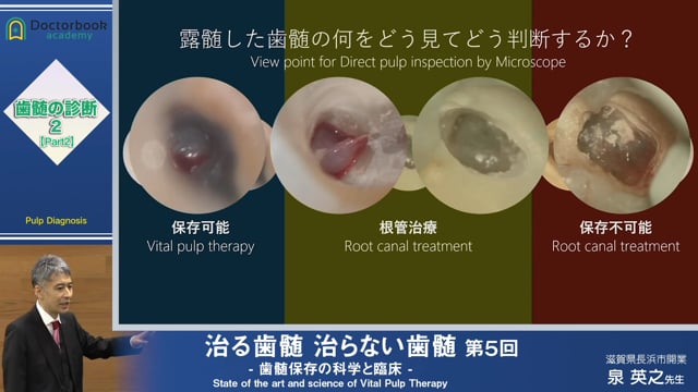 治る歯髄 治らない歯髄 - 歯髄保存の科学と臨床 - 第５回 「歯髄の診断 