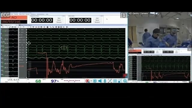 HeadStart 2020: Live Case from Essex Cardiothoracic Centre