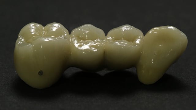 4 elemente metalo-ceramica