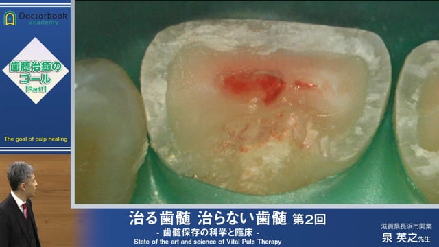 #1 外傷歯から歯髄の治癒を考える