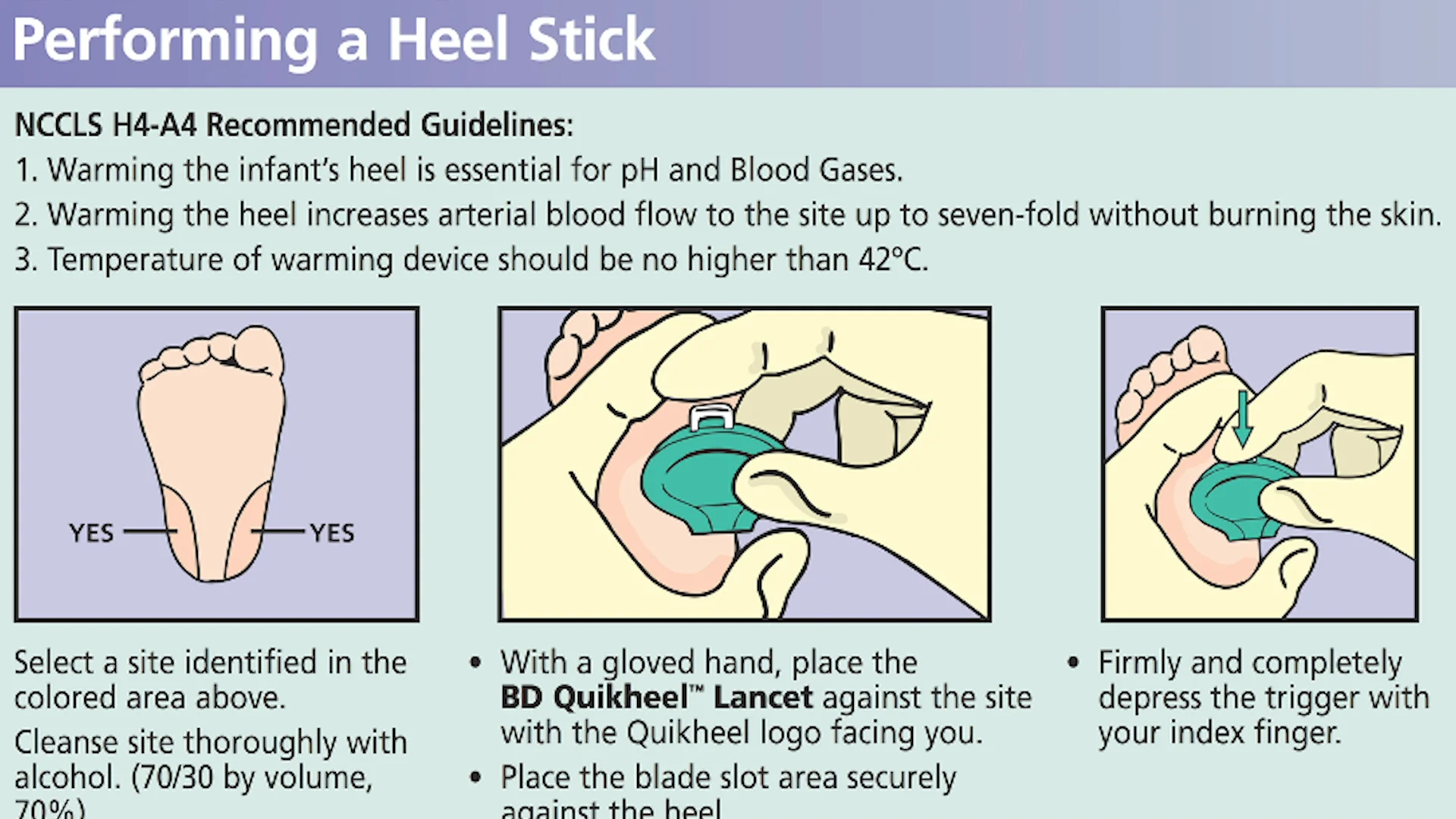 Module 19 Essential Extras Section 1 Example of an Infant Heel Stick