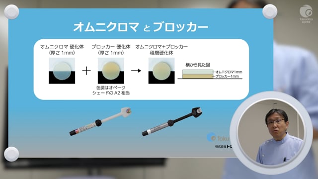 「OMNICHROMA」を用いた臼歯部コンポジットレジン修復