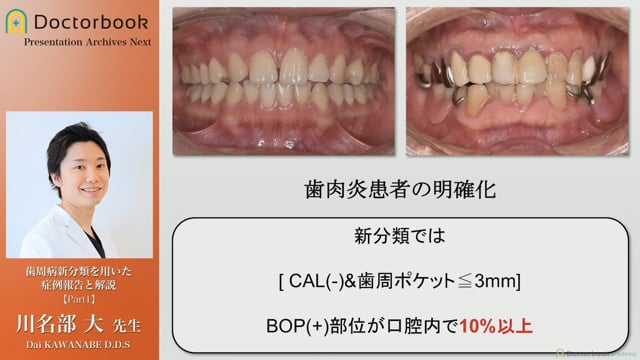 歯周病新分類を用いた症例報告と解説 | Doctorbook academy (ドクター