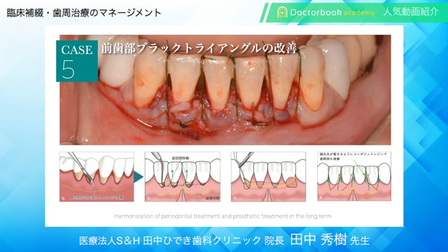 臨床補綴・歯周治療のマネージメント | Doctorbook academy (ドクター 