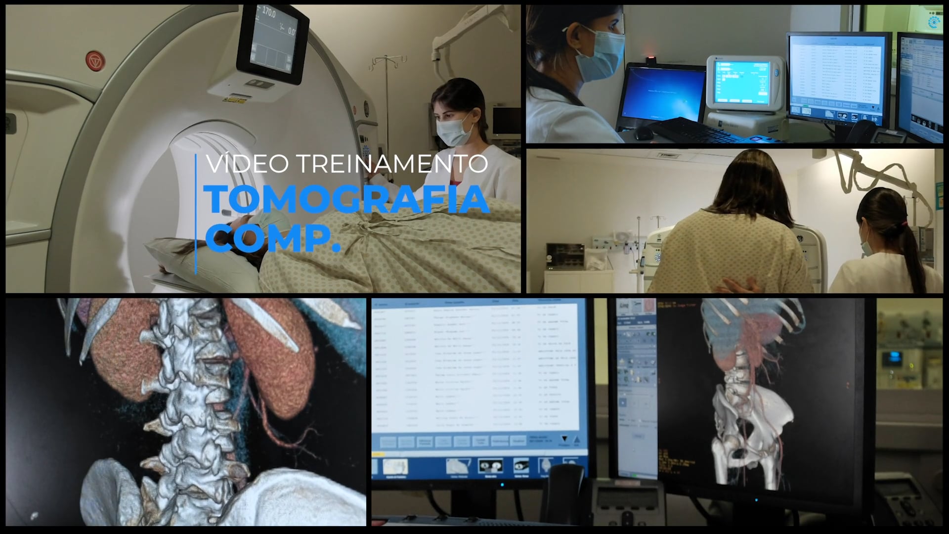 Tomografia Computadorizada