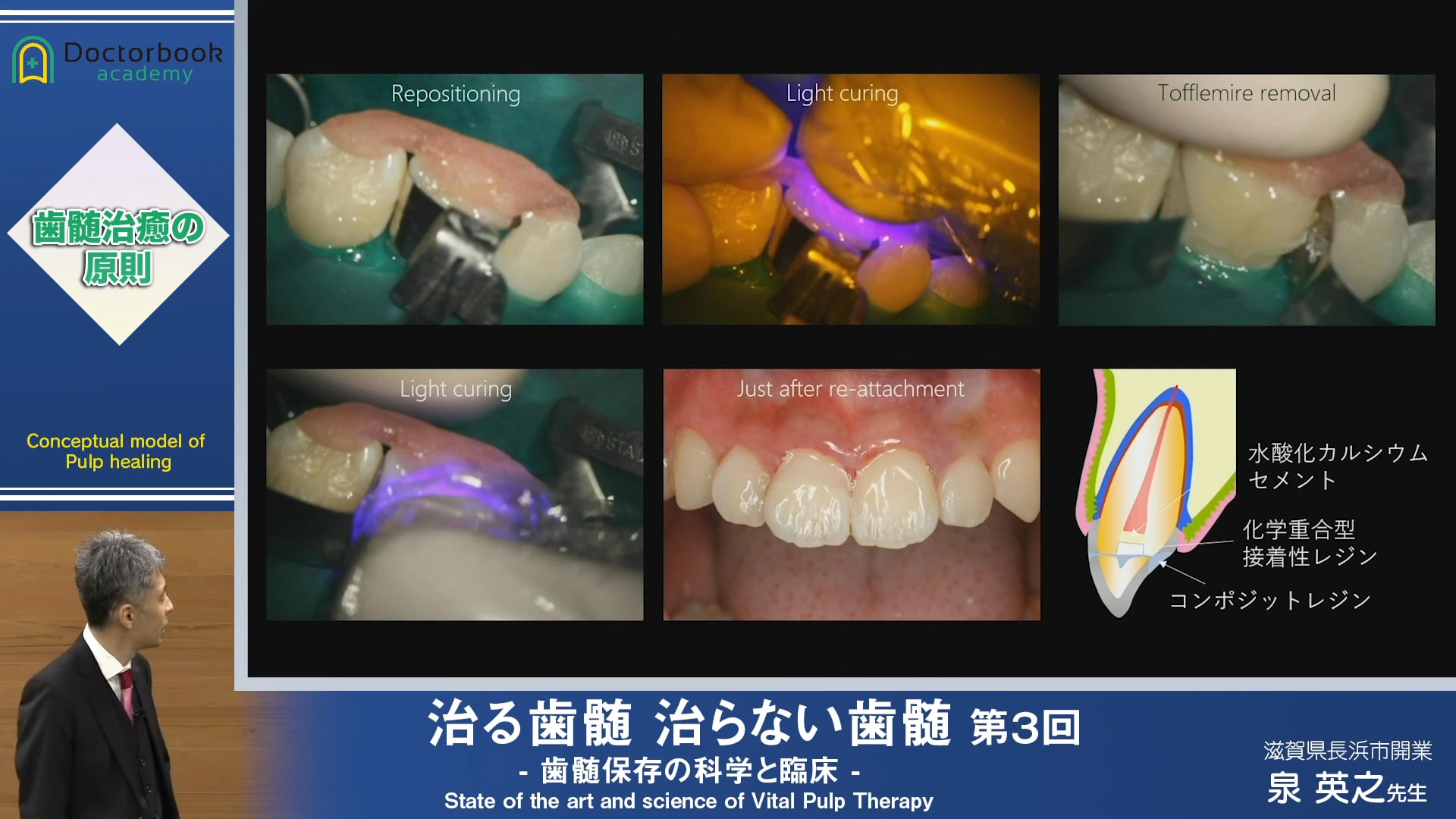 治癒のゴールと治療のゴール